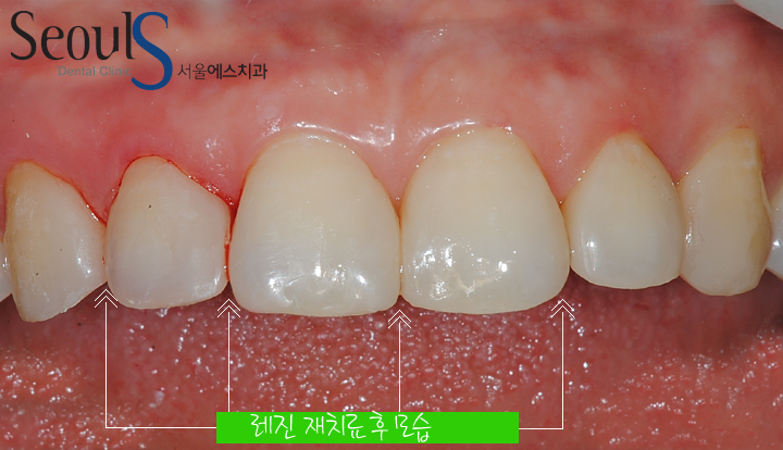 20160915-joeunsook-4