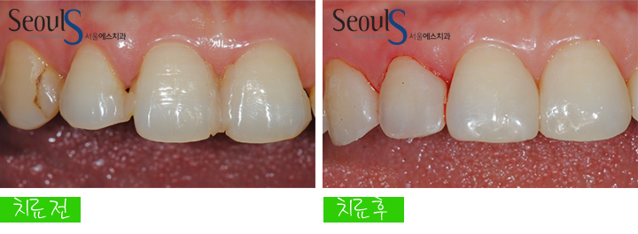 20160915-joeunsook-5