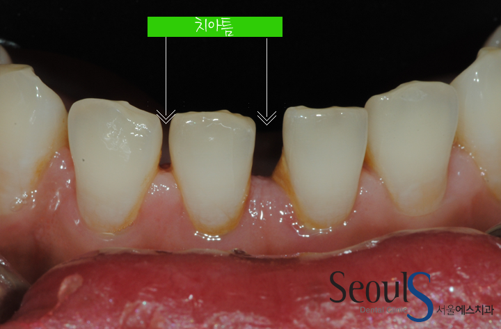 20160915-joeunsook-6