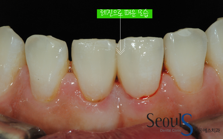 20160915-joeunsook-7