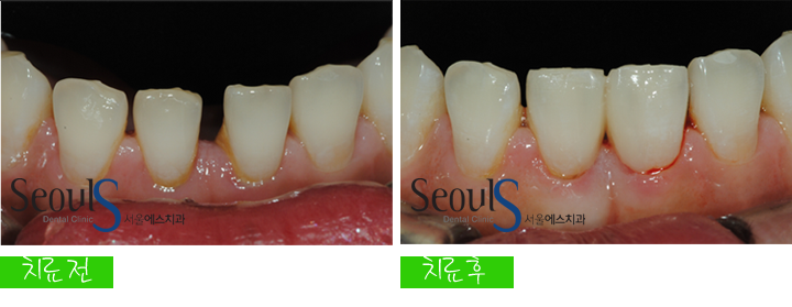 20160915-joeunsook-8