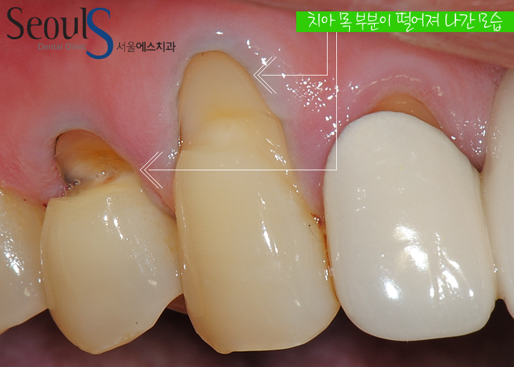 2016110ckb-1