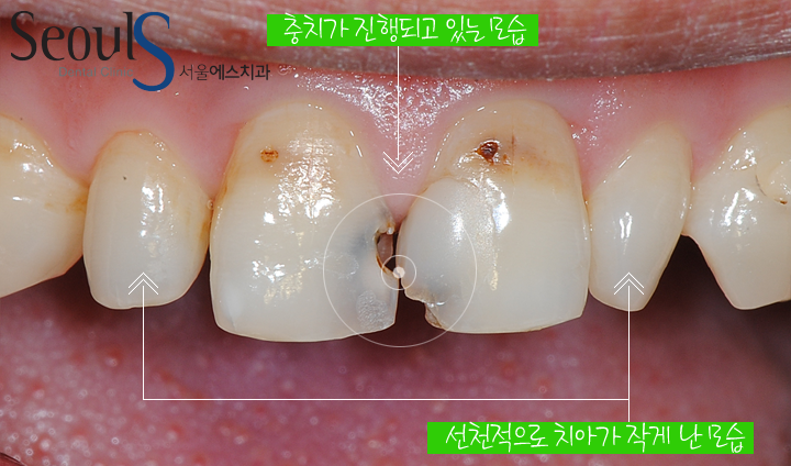 20161115_hungtea-4