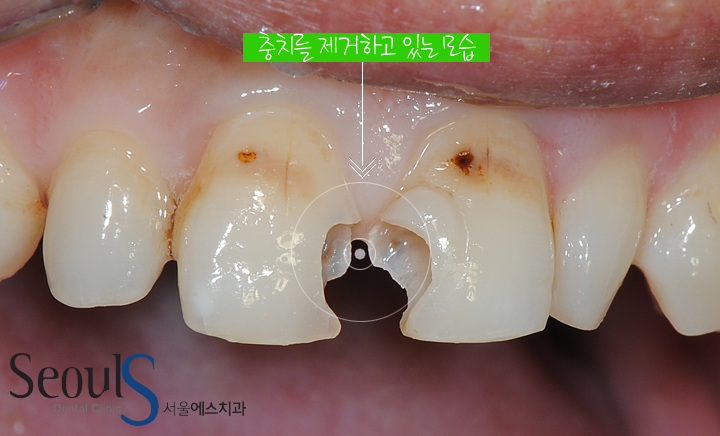 20161115_hungtea-5