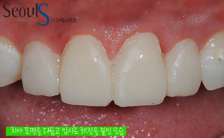 20161115_hungtea-7
