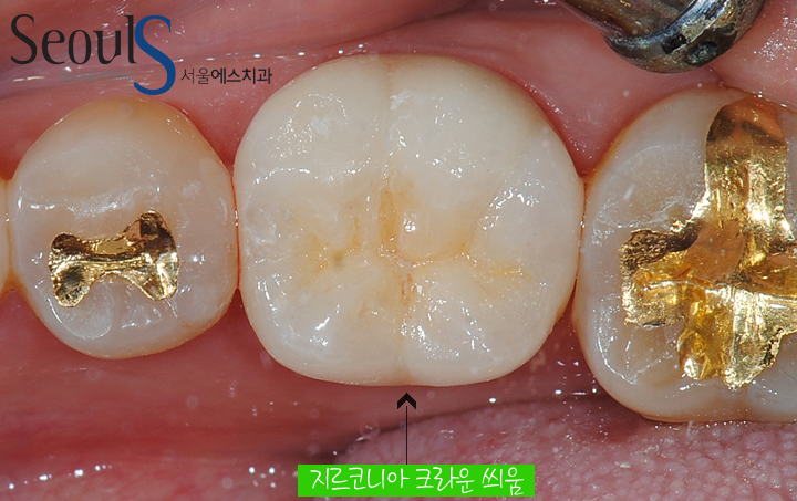 20161117zir-11