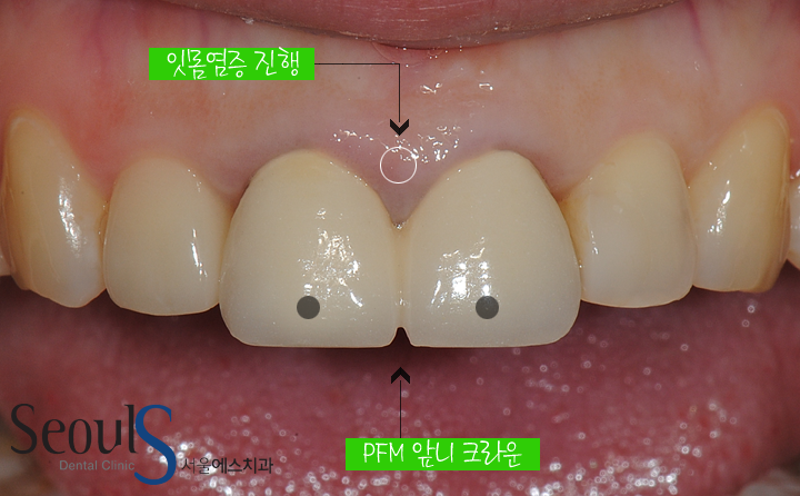20170126-allcera (2)