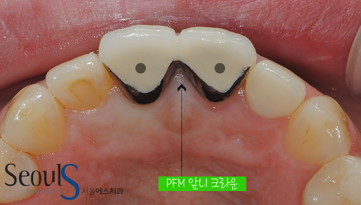 20170126-allcera (3)