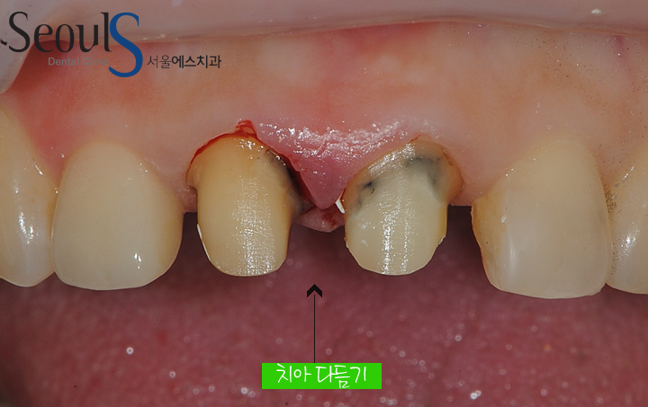 20170126-allcera (5)