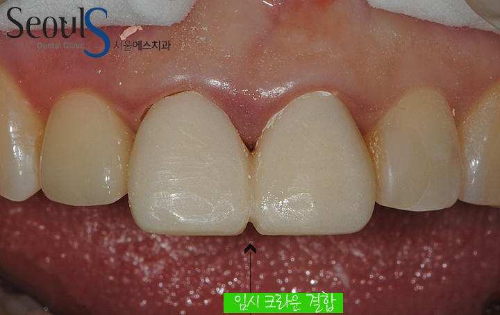 20170126-allcera (6)