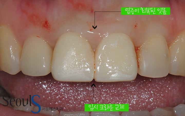 20170126-allcera (7)