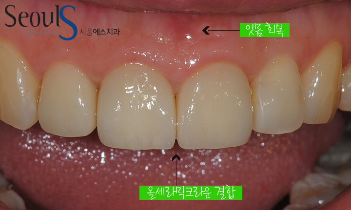 20170126-allcera (8)