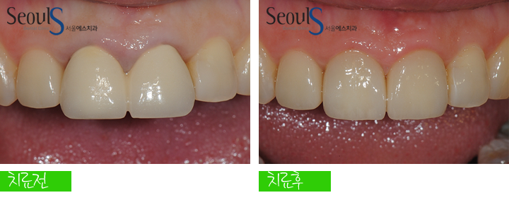 20170126-allcera (9)